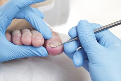 soin de l'ongle soin de l'ongle
